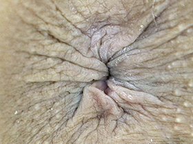 300人の尻穴　サンプル画像05